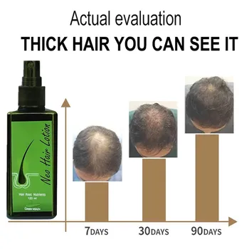 120ml Neo Lase losjona za Rast Las Serum Bistvo Olje Zdravljenje izpadanje Las, Rast Las za Moške, Ženske, Tajska Anti Hair Loss Spray